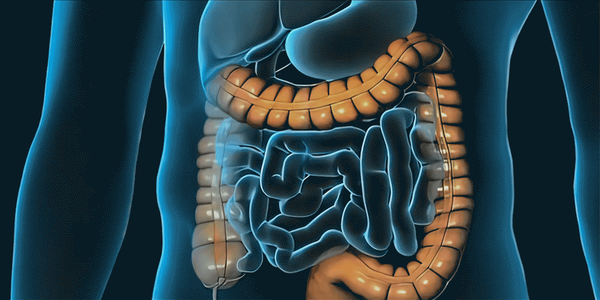 Colonoscopy