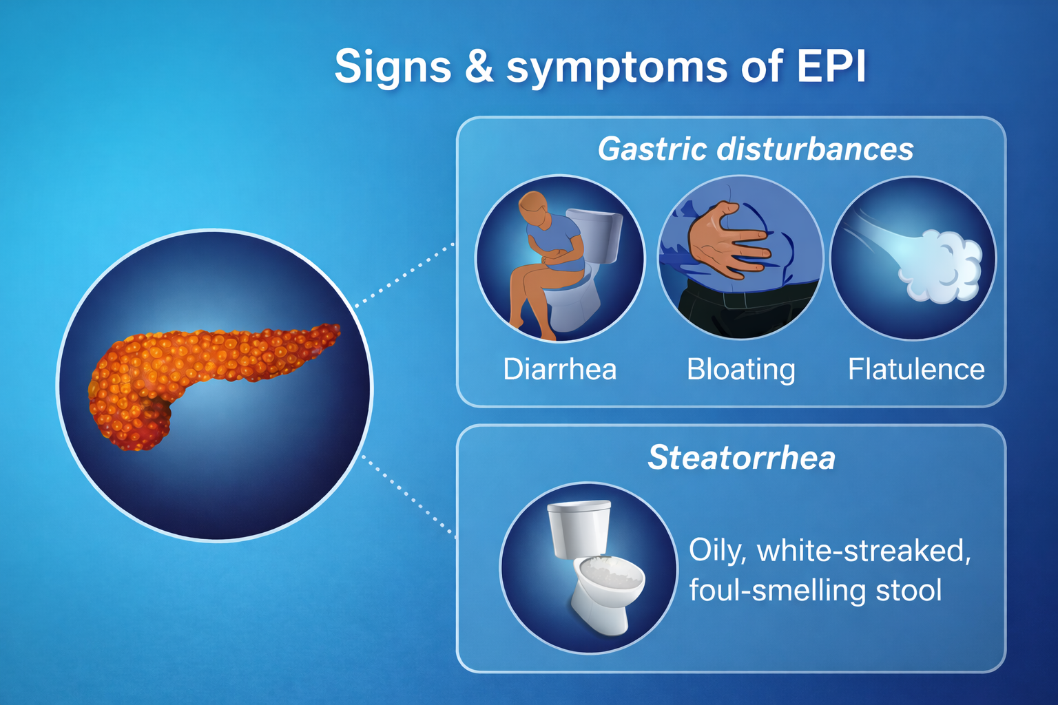 pancreatitis